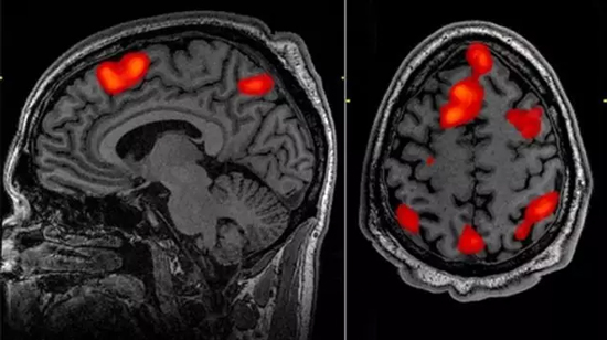 脑科学麻烦了：fMRI分析爆重大缺陷