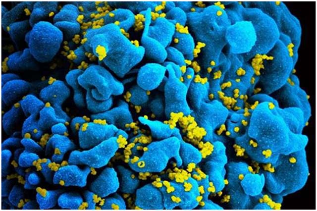JVI：首次利用CAR-T免疫疗法杀死被HIV感染的细胞