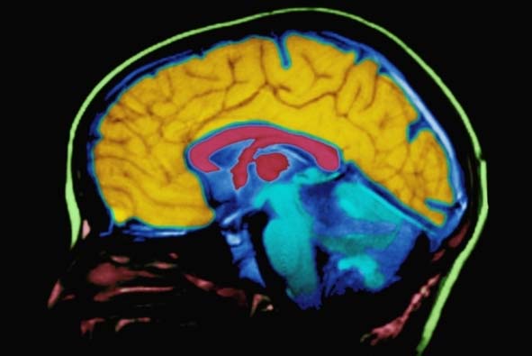 人类大脑图谱细节公开：97个人类大脑皮层首次公布