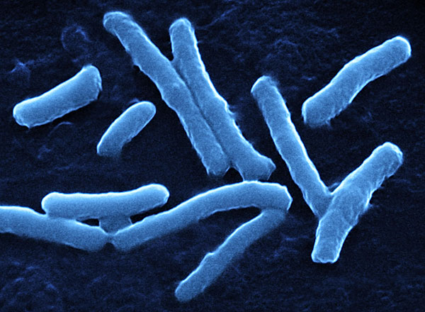 艰难梭状芽孢杆菌抗生素进入FDA快速审批通道