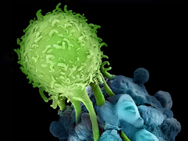 Science：抗肿瘤免疫疗法除了PD-L1，还可以选择破坏Cdk5