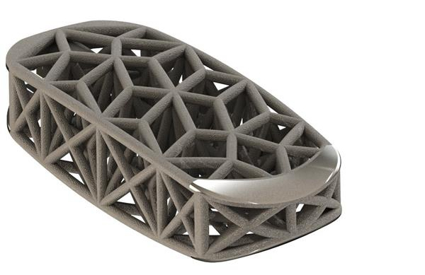 4WEB公司3D打印侧向脊柱桁架系统获FDA批准