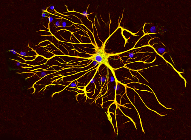 神经元也有“充电器”：星形胶质细胞有助脑损伤患者实现恢复