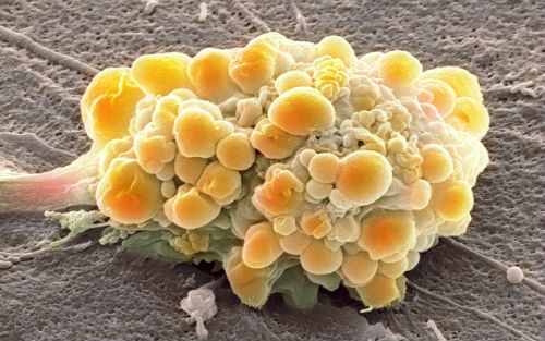 Nature：50年，2000篇论文！这个癌细胞系一直被错用
