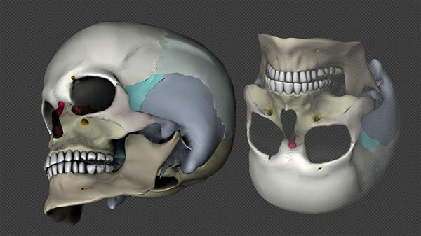 新西兰科学家利用3D生物打印和干细胞制造出可再生新骨骼