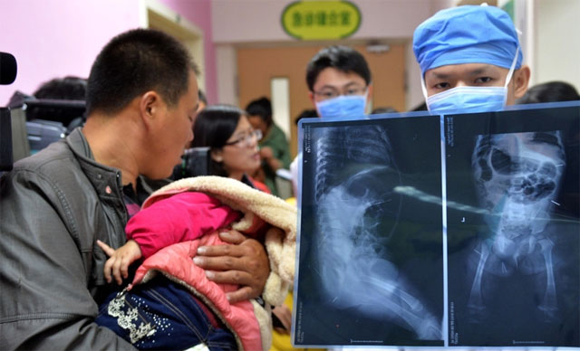 患者不动医生动，北京儿童医院集团如何实现优质资源全国共享？
