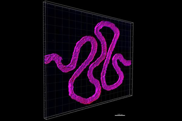哈佛科学家3D生物打印出“活的”肾脏模型