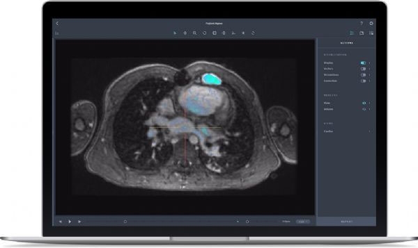 FDA批准Arterys心血管MRI分析软件上市