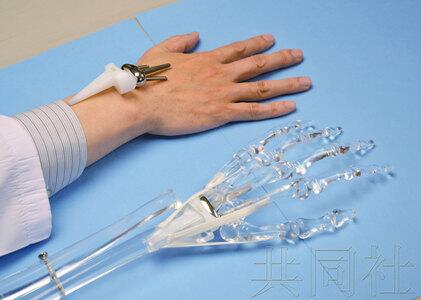日本医院研发出人工手关节，明春投入实际应用