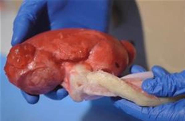 可解剖、会流血的逼真3D打印人体器官