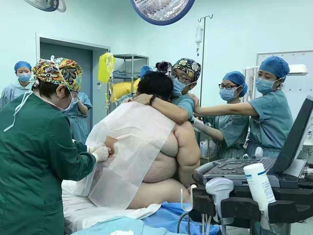 280斤孕妇生产，16名医务人员出动