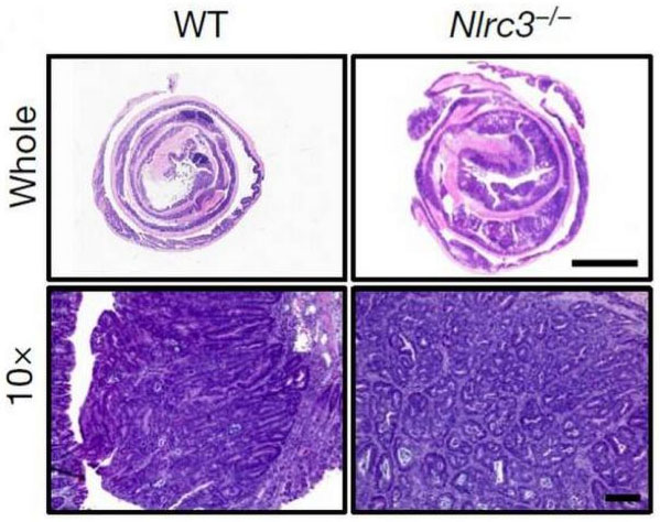 Nature解读：NLRC3，一类新型结肠癌关键抑制因子