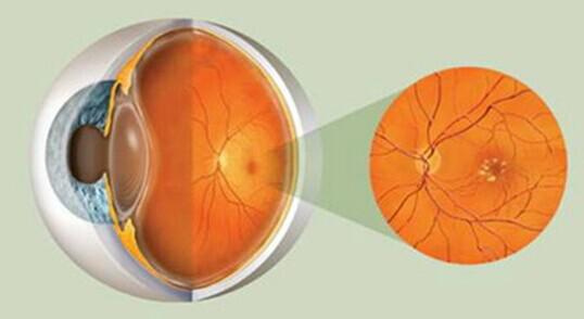 致盲眼病患者的福音！新纳米粒子或可缓解治疗痛苦