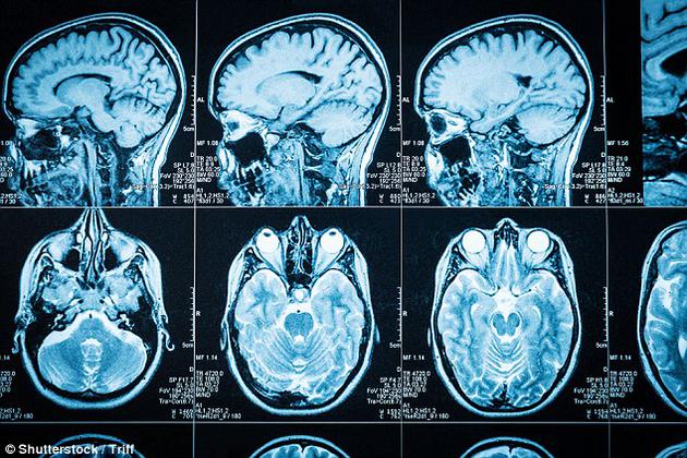 一种“解码神经反馈”新技术助你毫无察觉的提高自信心