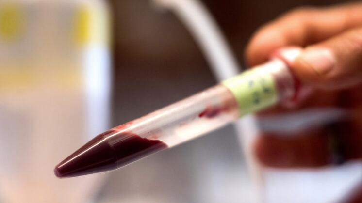 用人造血液可以替代人体血液？华盛顿大学的教授说可以