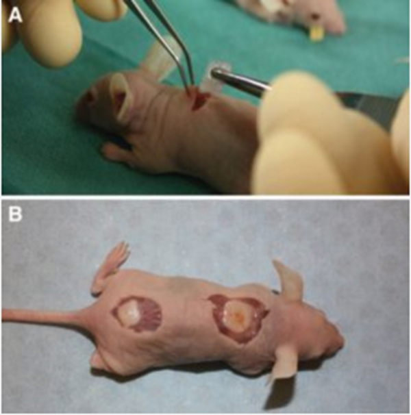 瑞典科学家成功让3D打印人体软骨细胞在老鼠身上生长和血管化