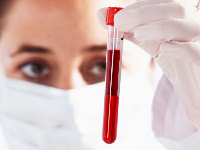 “滴血”辅助癌症治疗，科学家有新成果