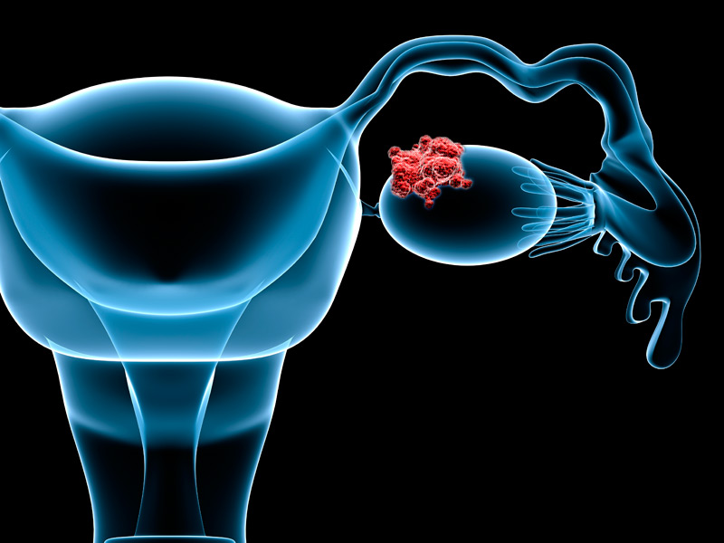 中国研究显示干细胞有望治疗卵巢早衰