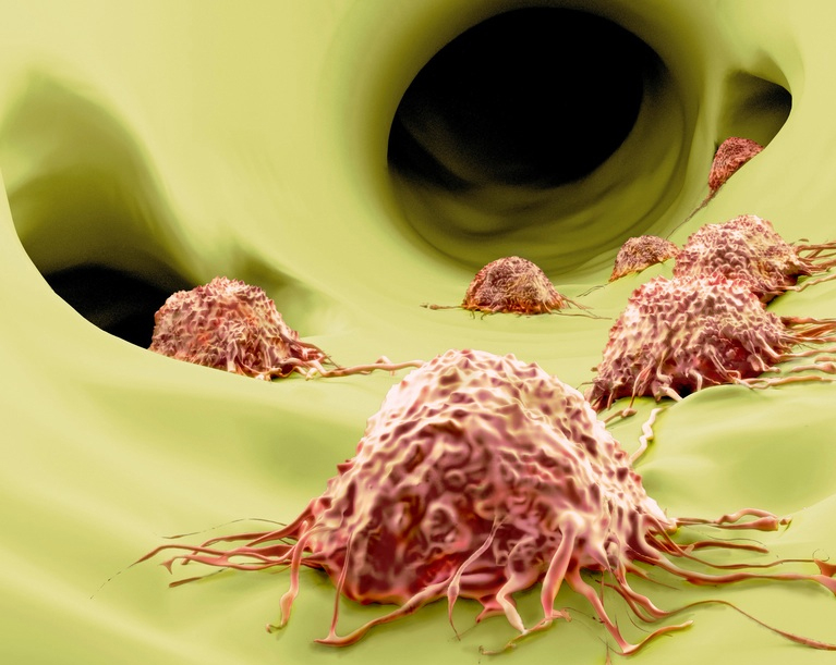 日本科学家发现抑制癌细胞转移化合物