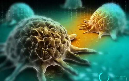 《自然》子刊：有些癌细胞转移竟然是被“挤”走的！新疗法或能阻止这一过程
