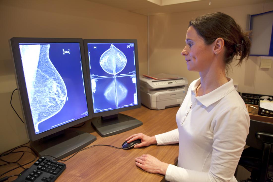 一项大型研究结果，使我们能够更为精准地评估罹患乳腺癌和卵巢癌的风险
