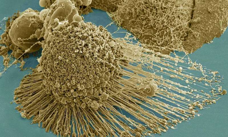 纳米棒治疗：打断癌细胞的“腿”，成功抑制癌症扩散