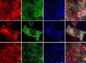 Stem Cell Reports:上海药物所利用单转录因子及小分子化合物诱导肝细胞转分化