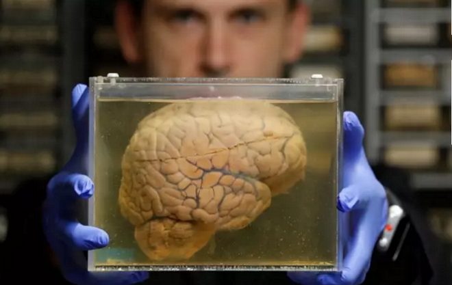 用皮肤培养一个大脑，你就能获得永生？