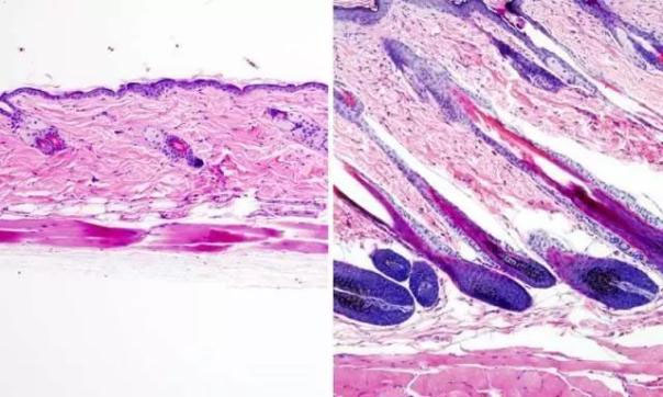 Nature： 科学家揭示激活干细胞使头发生长的新途径