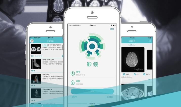 用互联网平台运营影像医生集团，影领科技获千万Pre-A轮融资