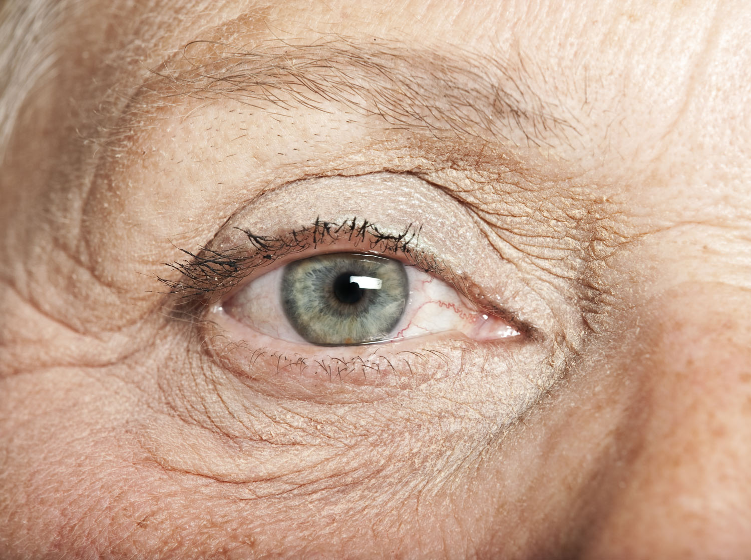 JCI Insight：视网膜扫描技术或可检测阿尔茨海默症前兆