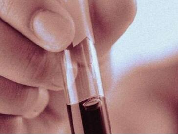 NEJM：CRISPR立新功，助力找到导致红细胞增多症的第一个遗传突变！