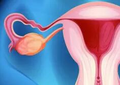 无症状女性常规筛查卵巢癌意义不大