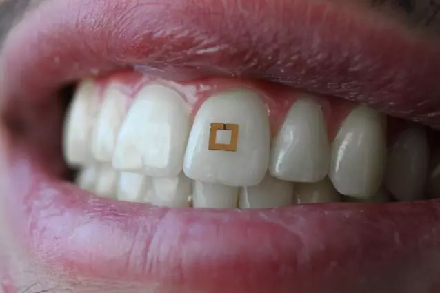 安装在牙齿上的传感器，帮助你追踪都吃了什么