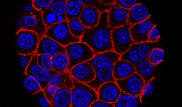 Science & Cell：重磅！结构性研究解读癌细胞对化疗耐受的分子机制！