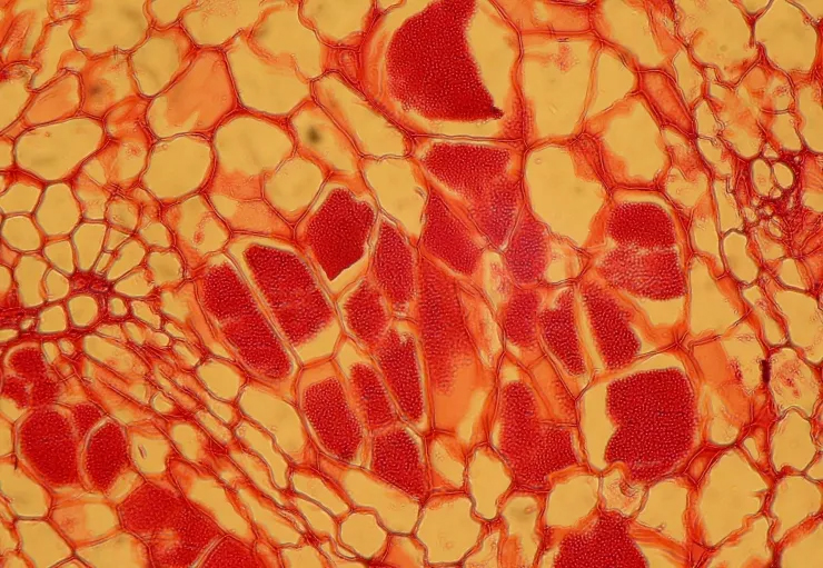 Google 重磅医疗 AI 成果：增强现实显微镜可实时分析病理切片