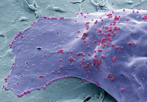 资金缩减，基因组编写计划转向制造病毒抗性细胞