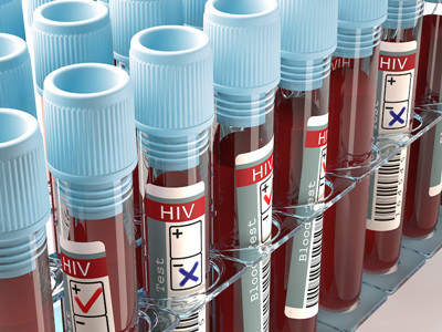 2020年治愈HIV？细数4类最具潜力的HIV疗法