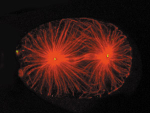 细胞中心体的扩增效应或能开启癌症