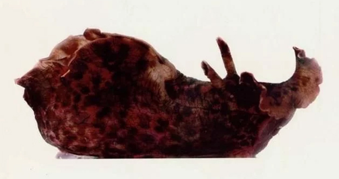 记忆移植已在蜗牛身上实现，下一步或将是人类