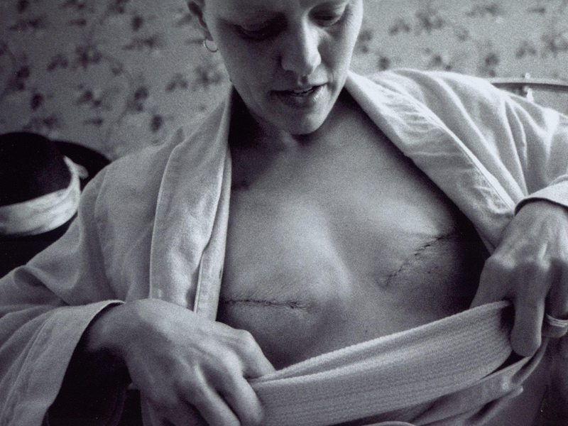 研究人员推动三阴性乳腺癌个性化治疗