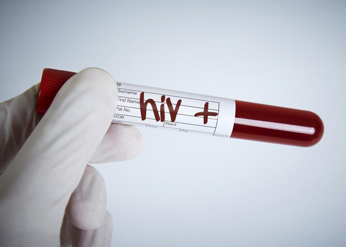 科学家利用基因编辑技术治疗艾滋病