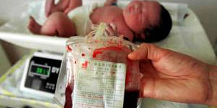 脐带血有助于脑卒中后恢复