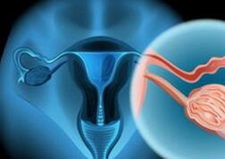 不只是HPV，研究发现宫颈癌与阴道细菌、PH值失衡也有关