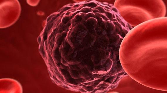 多模态融合切除延髓胶质瘤 