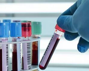 Science重大突破：无创血液检测——准确预测“早产、预产期”的新技术！