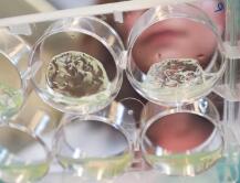 攻克1型糖尿病有望，新型材料可助力胰岛移植