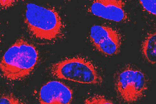 一氧化氮抗肿瘤纳米药物研究新进展