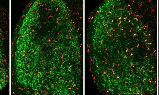 小胶质细胞可以清除大脑损伤后的残留神经元