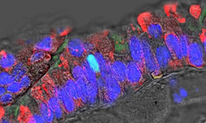 肺癌治不好很可能是不对症，新类型肺癌已确定